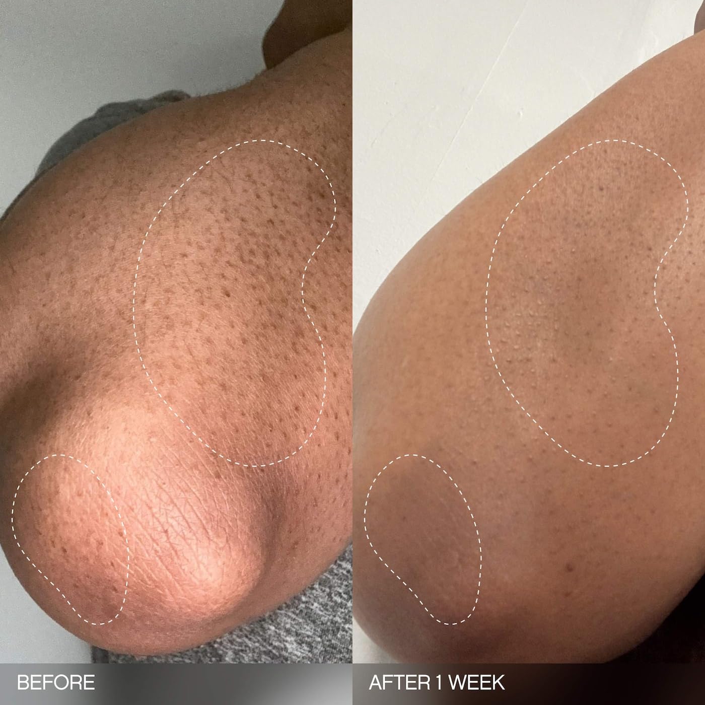 Topicals Slather Exfoliating Bar safe for sensitive skin use