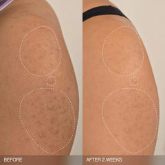 Topicals Slather Exfoliating Bar targets KP texture for visibly refined skin