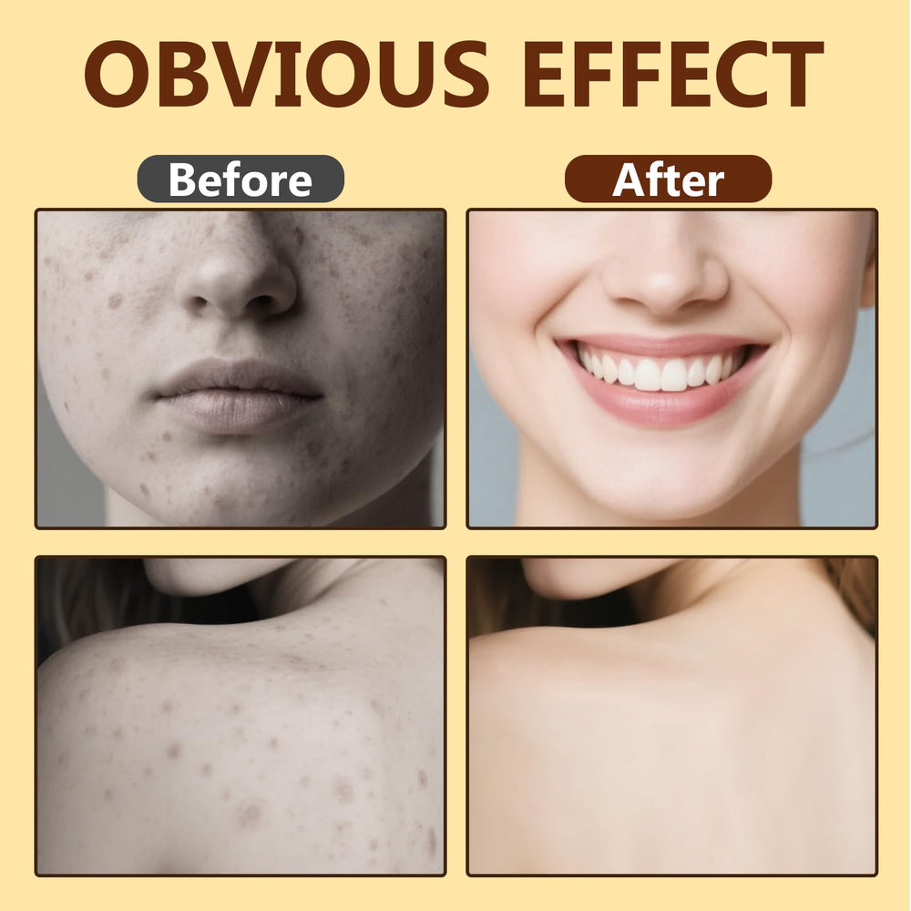 Topicy Bee Venom Cream dermatologist-tested formula supports sensitive skin.