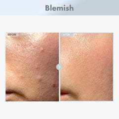 TOSOWOONG Niacinamide 15% serum pump closeup for easy application