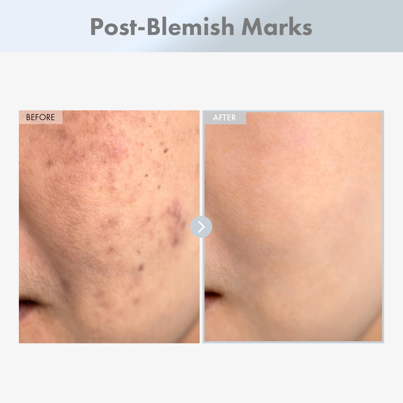 TOSOWOONG Niacinamide 15% serum texture swirl shows smooth absorption