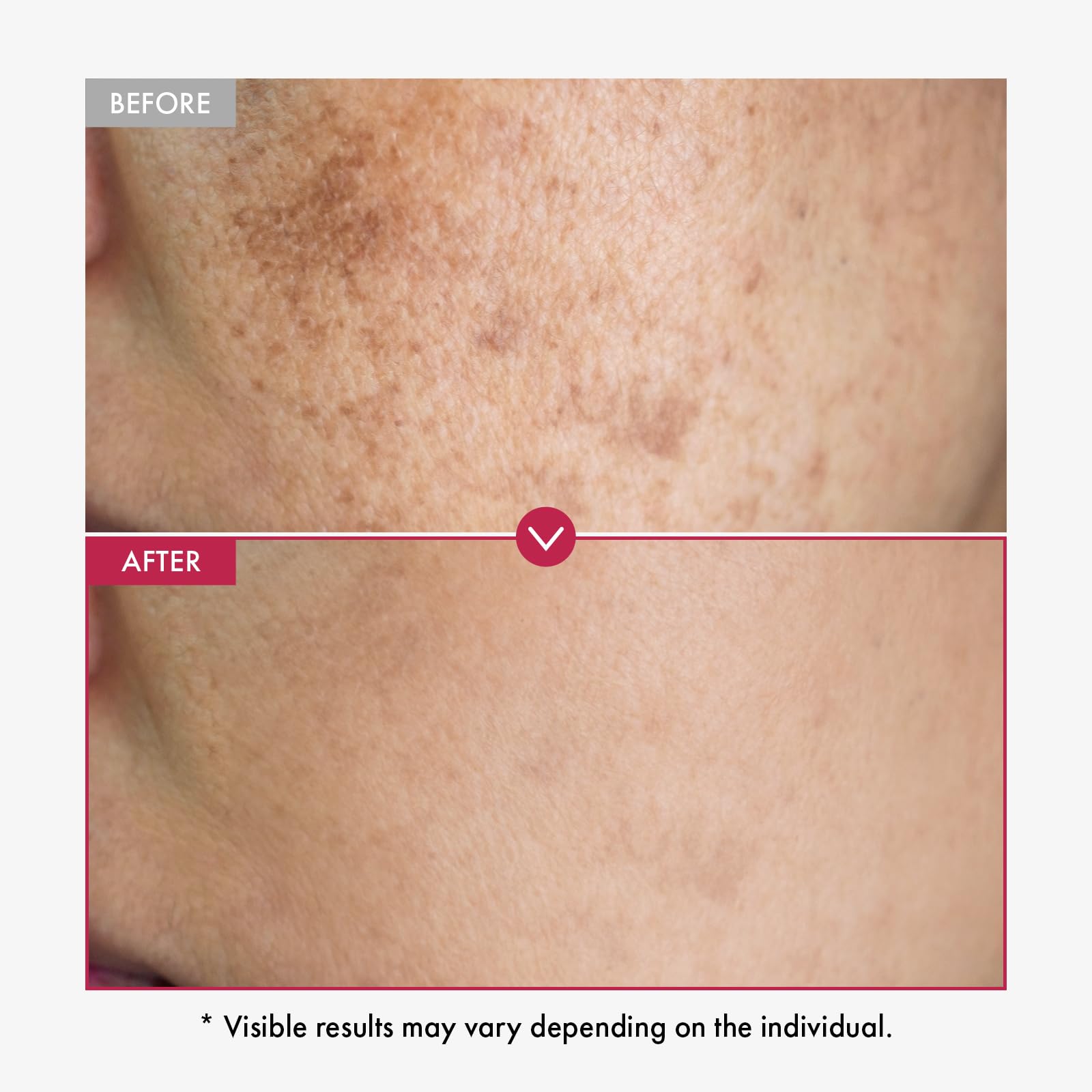 TOSOWOONG Niacinamide serum pink color reflects the nature-driven tint and aesthetics.