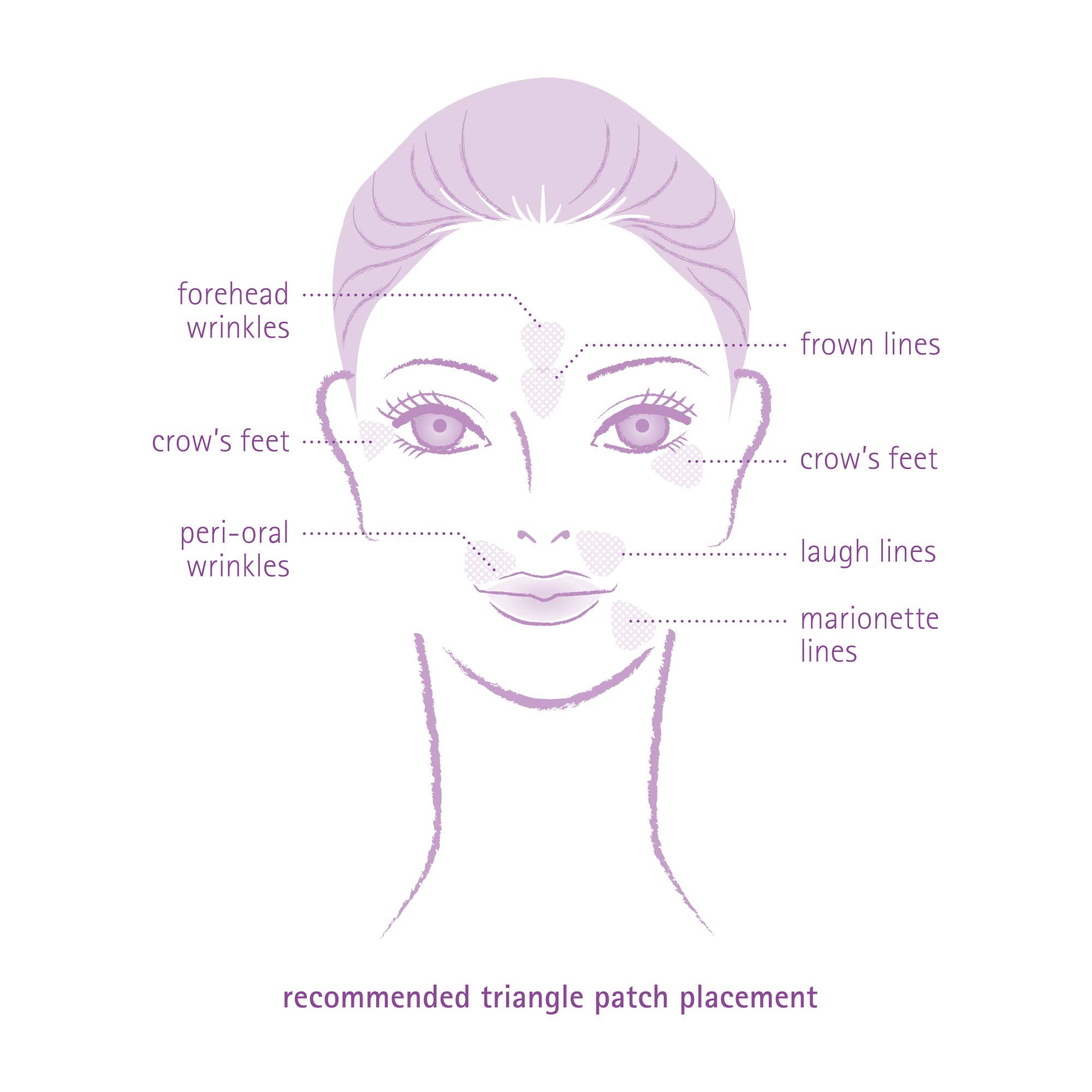 Toute Nuit Triangle Wrinkle Patches address laugh lines for a natural look.
