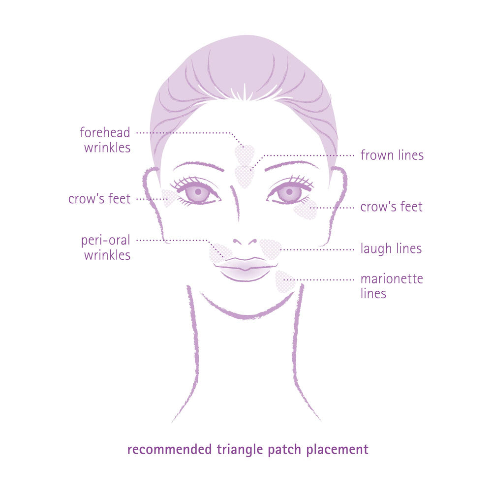 Toute Nuit Triangle Wrinkle Patches address laugh lines for a natural look.
