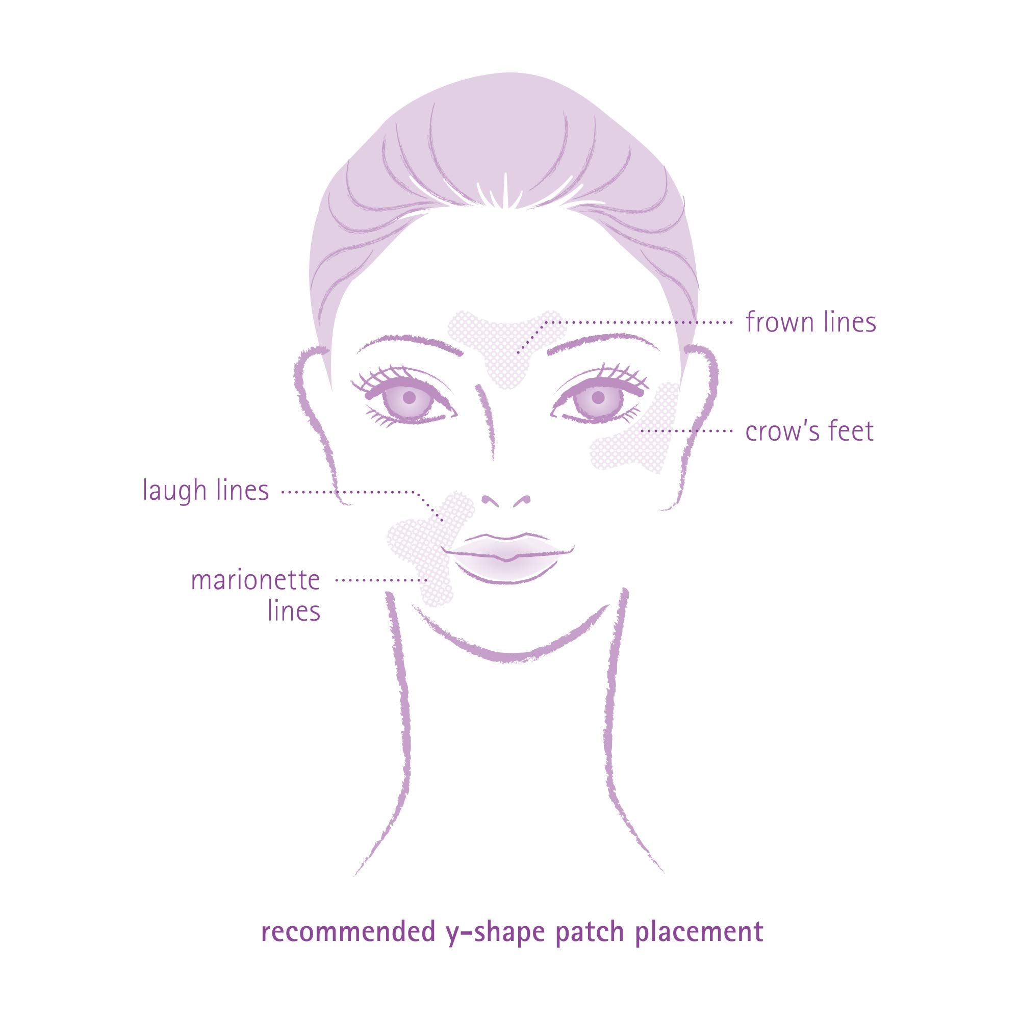 Toute Nuit Y-shape patches closeup highlights broader coverage design
