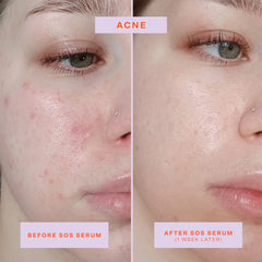 Tower 28 SOS Rescue Face Serum bottle close-up highlights fragrance-free, soothing formula for sensitive skin.