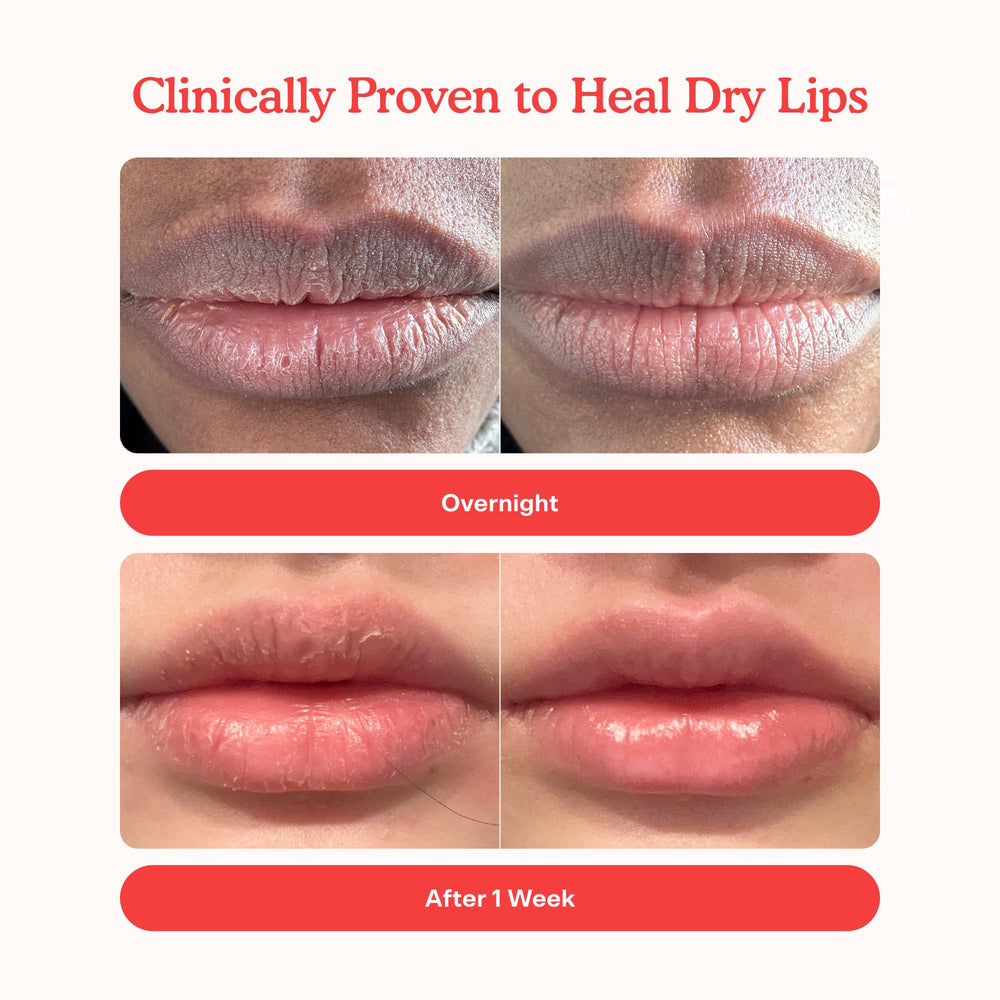 LipSoftie applies smoothly for instant comfort and long-lasting hydration