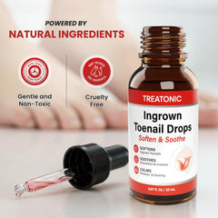 Treatonic applicator and drops in use smoothing the nail groove for gentle removal.