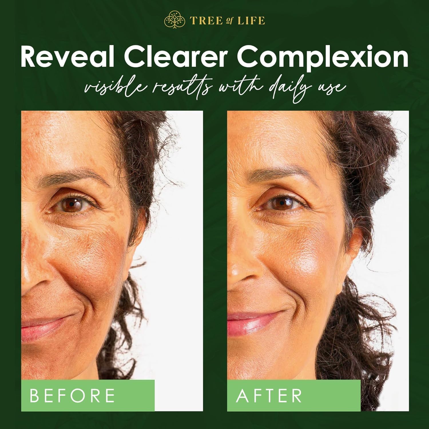 Tree of Life Niacinamide serum dark spots close-up hints at brightening potential