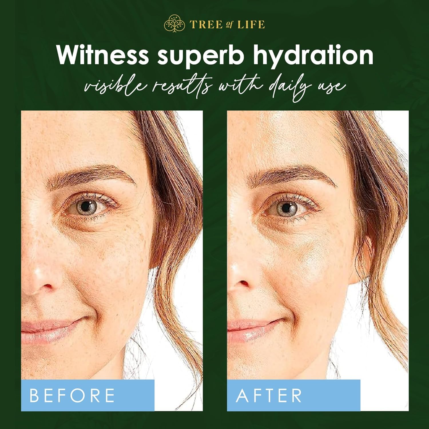 Tree of Life Hyaluronic Serum close-up shows a healthy natural glow.
