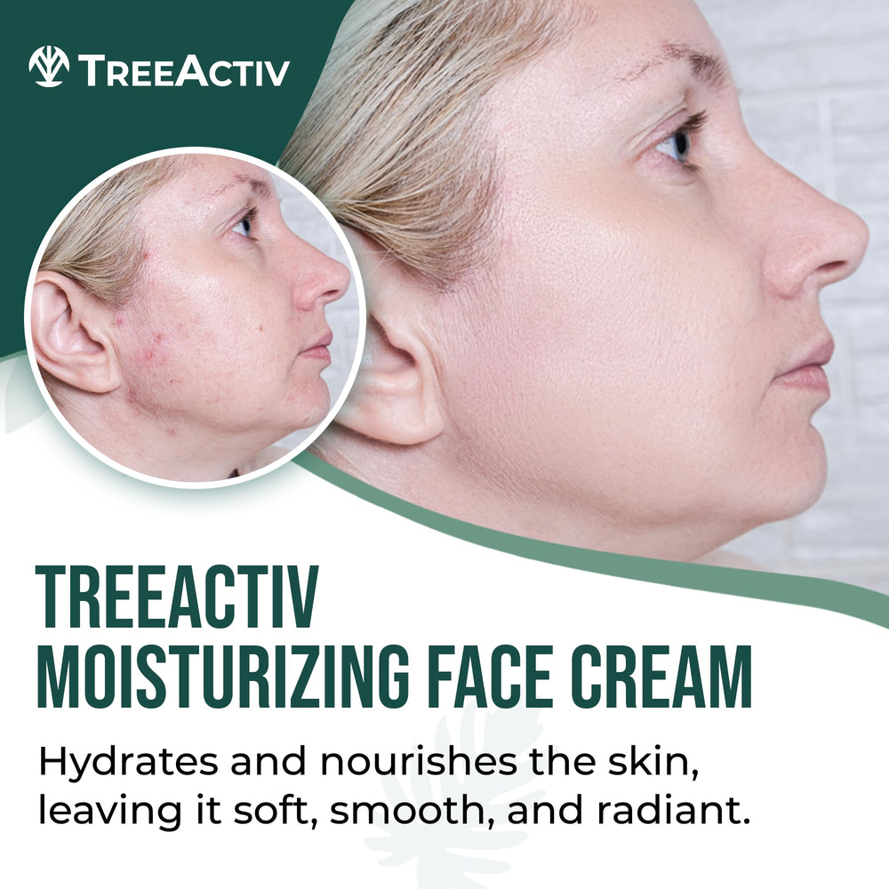 TreeActiv Acne Eliminating Face Cream pump demonstrates mess-free application for daily skincare.