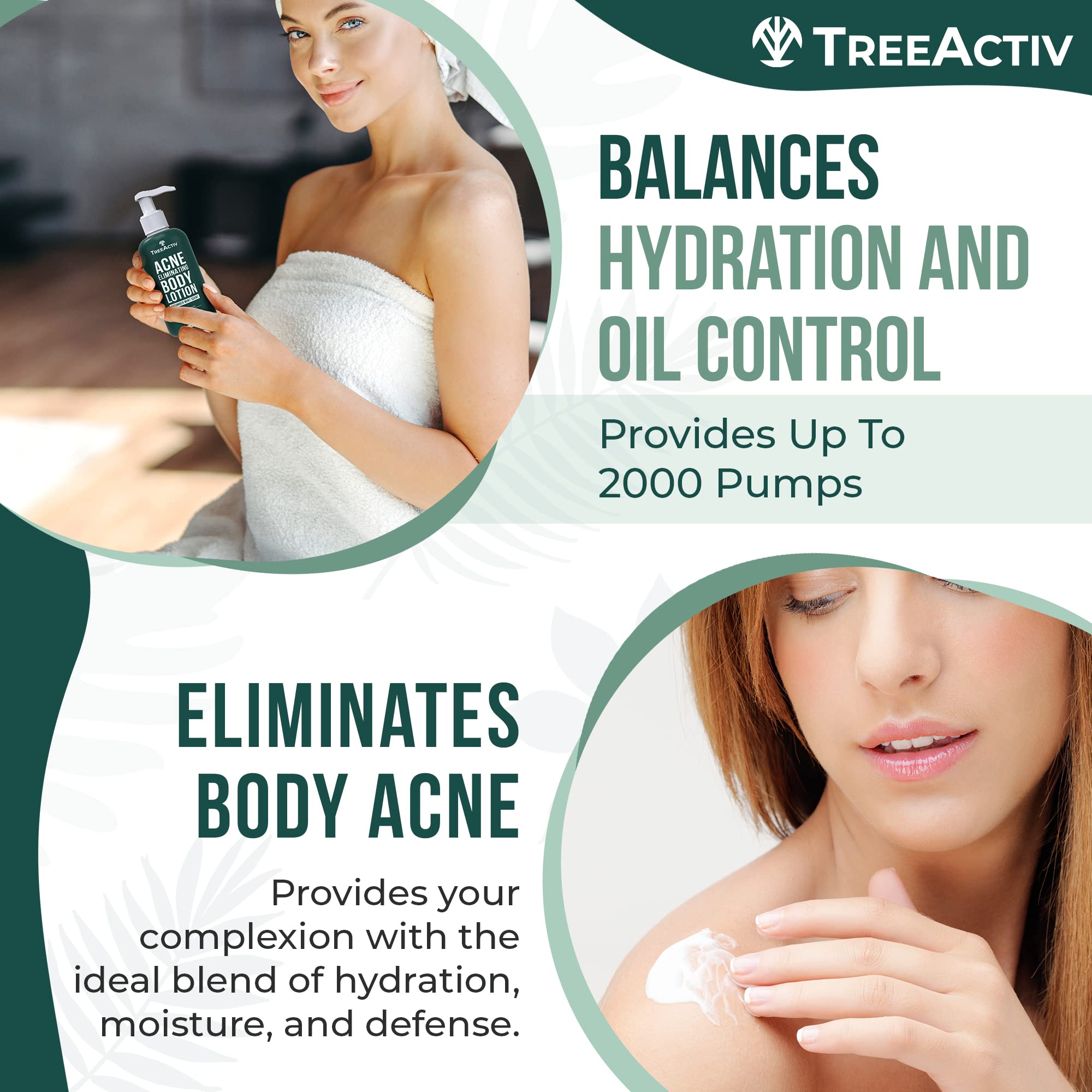 TreeActiv aloe vera hydrating lotion bottle closeup for soft, nourished skin.