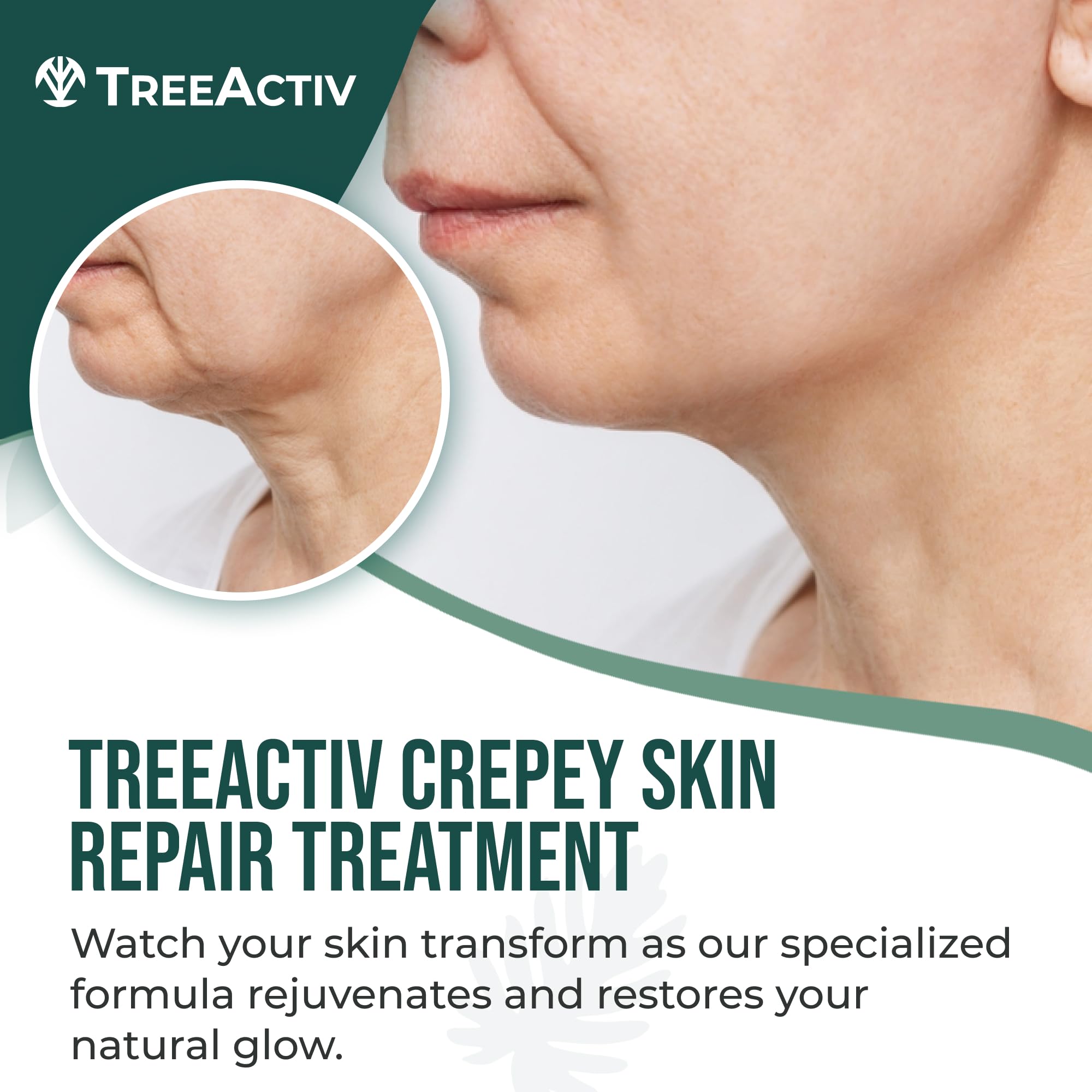 Texture close-up of TreeActiv Crepey Skin Repair Cream smoothing skin.