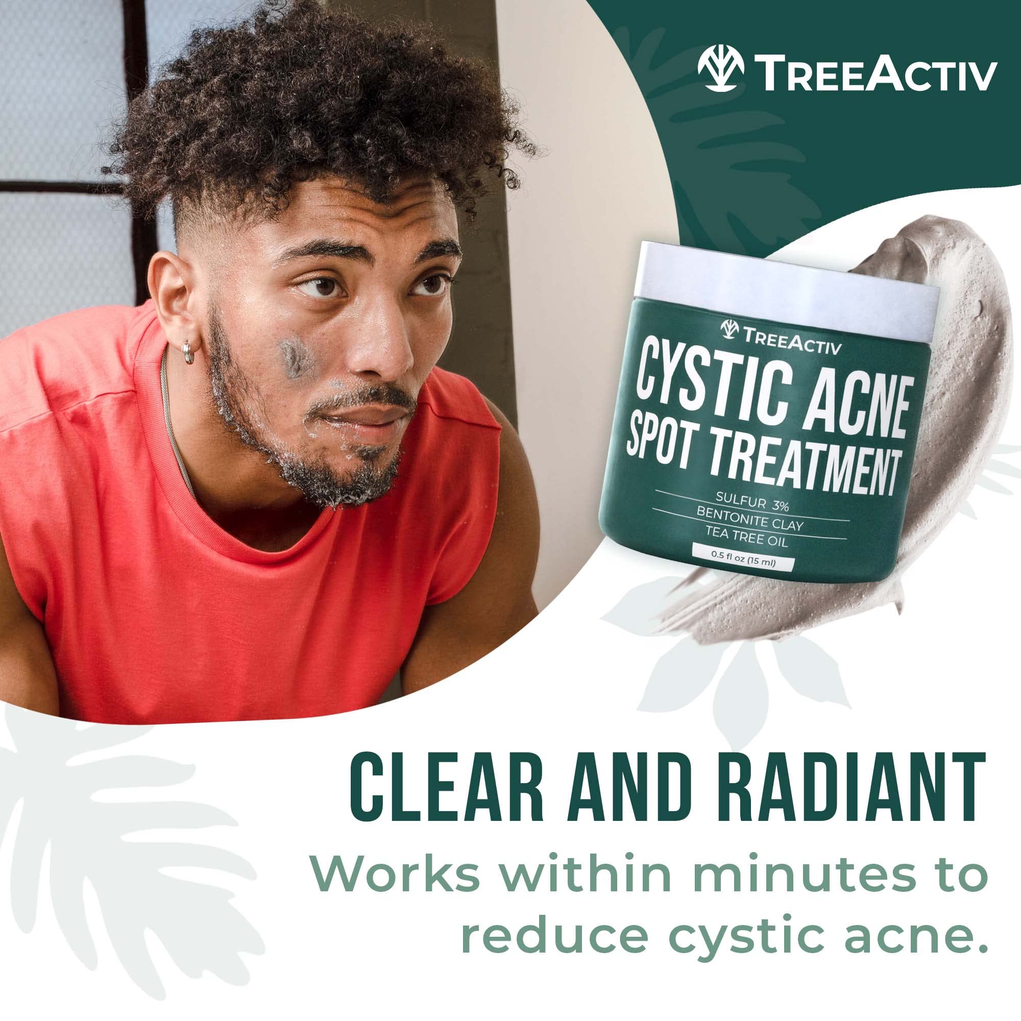 TreeActiv cystic acne treatment in a neat vanity setup