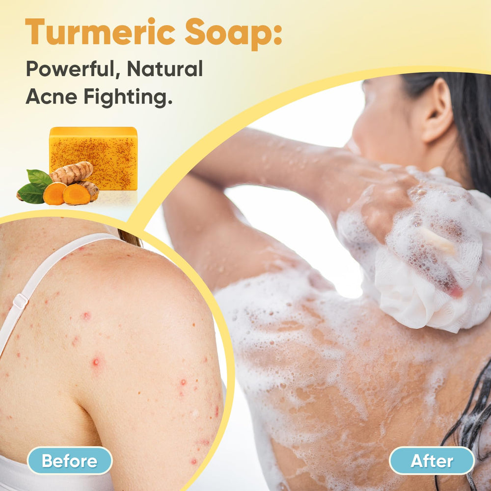 Treeroot Turmeric Soap with shea butter and coconut oil for nourishment.