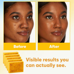 Treeroot turmeric soap mesh bag use enhances foaming and cleansing touch.