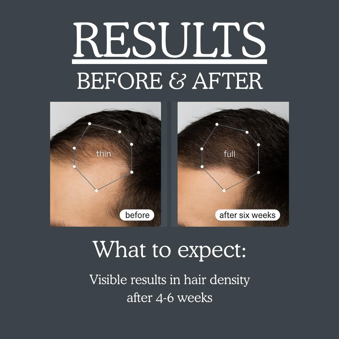 TRENDSTARTER bottle pour demonstrating invigorating scalp cleansing
