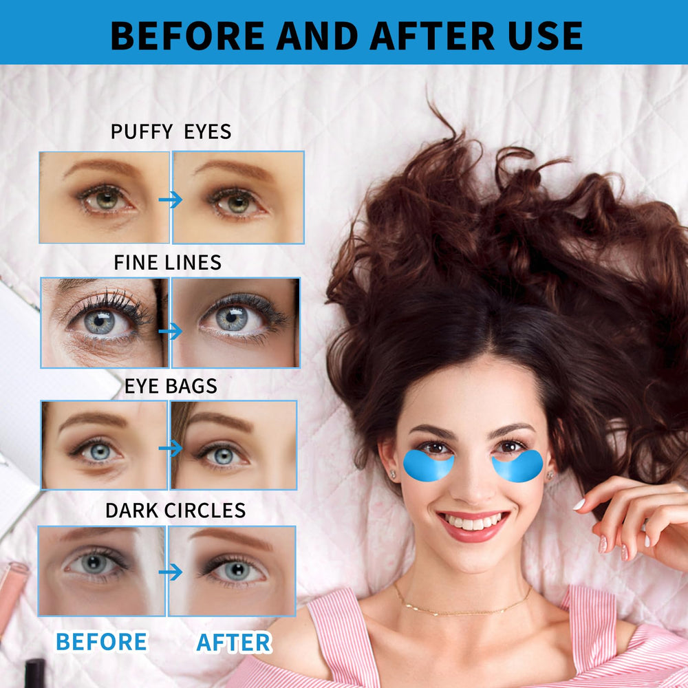 Treondexir natural ingredients eye patches soothe and rejuvenate delicate under-eye skin.