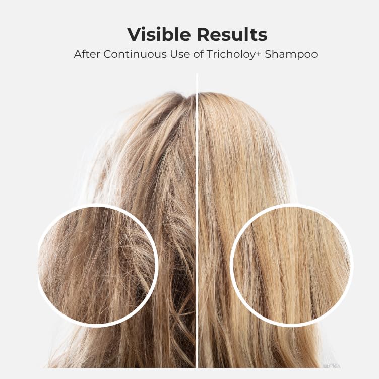 Tricholoy+ scalp and hair strengthening complex application