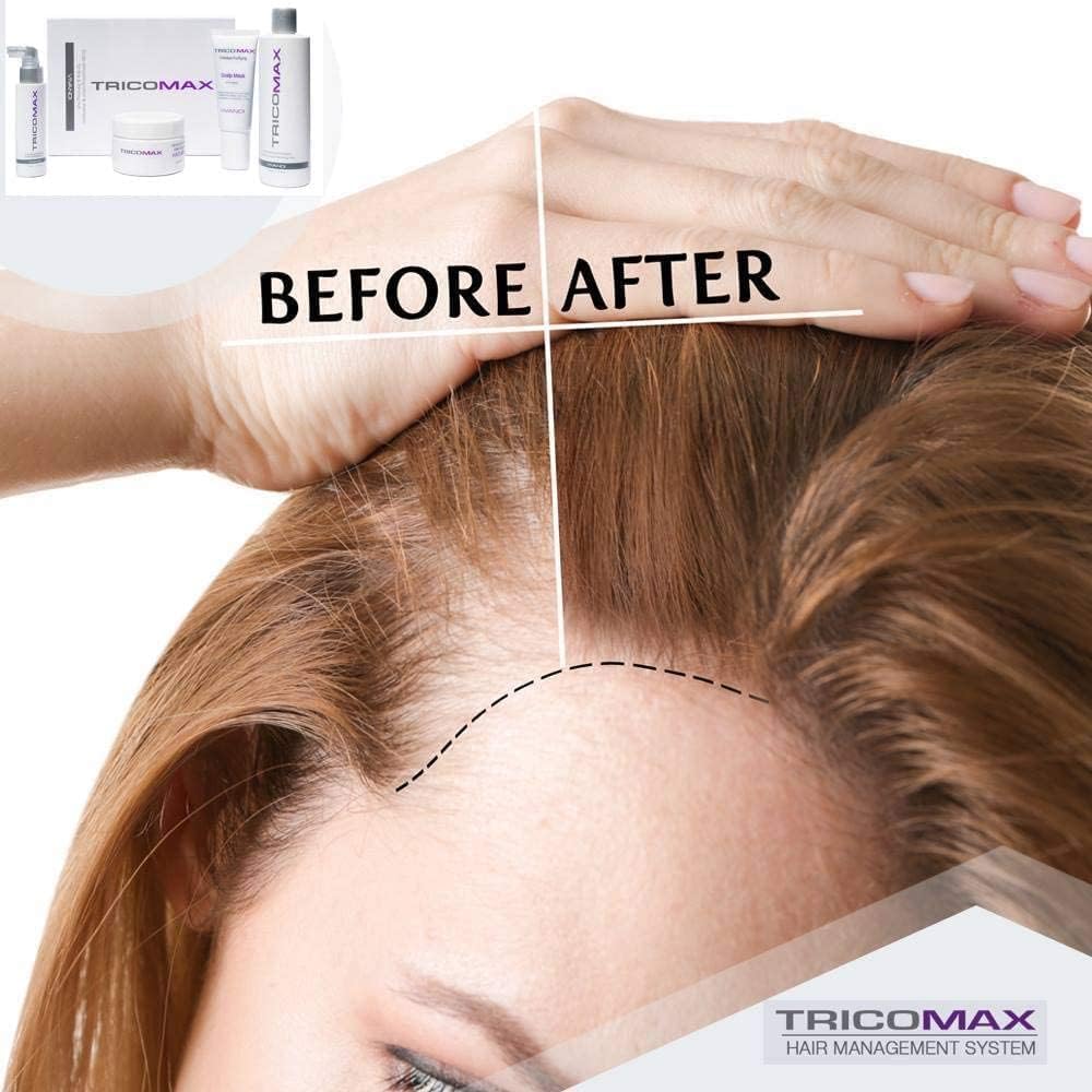 Tricomax Hair Growth capsules spilled on a surface for easy daily use