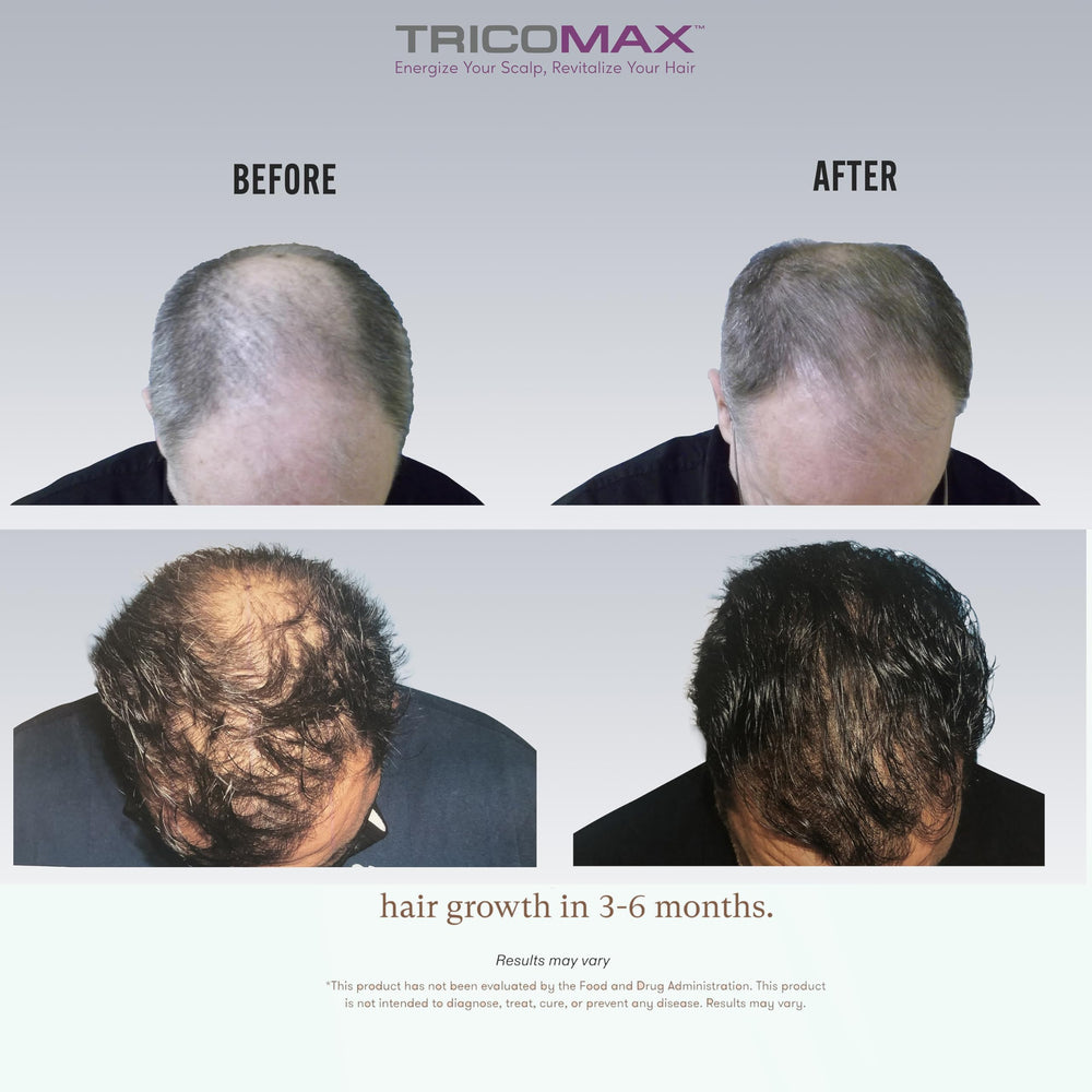 Tricomax Hair Growth packaging display conveying a complete beauty nutrition line