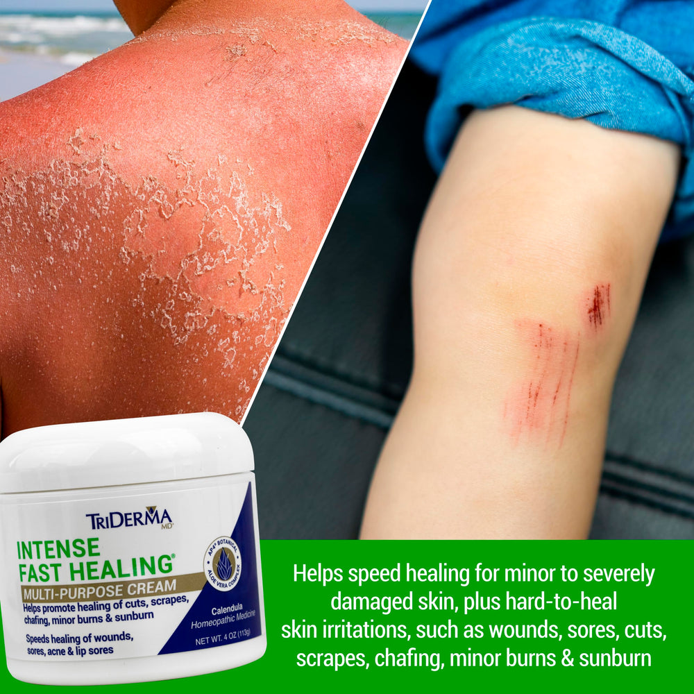 TriDerma Intense Fast Healing Cream on the face for gentle soothing use.