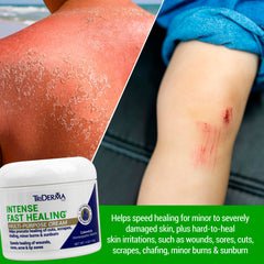 TriDerma Intense Fast Healing Cream on the face for gentle soothing use.