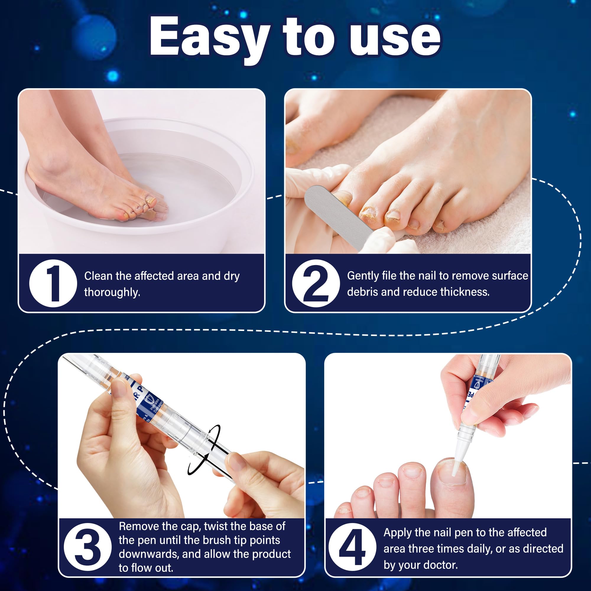Trihood nail files smoothing damaged nails to prep for treatment.