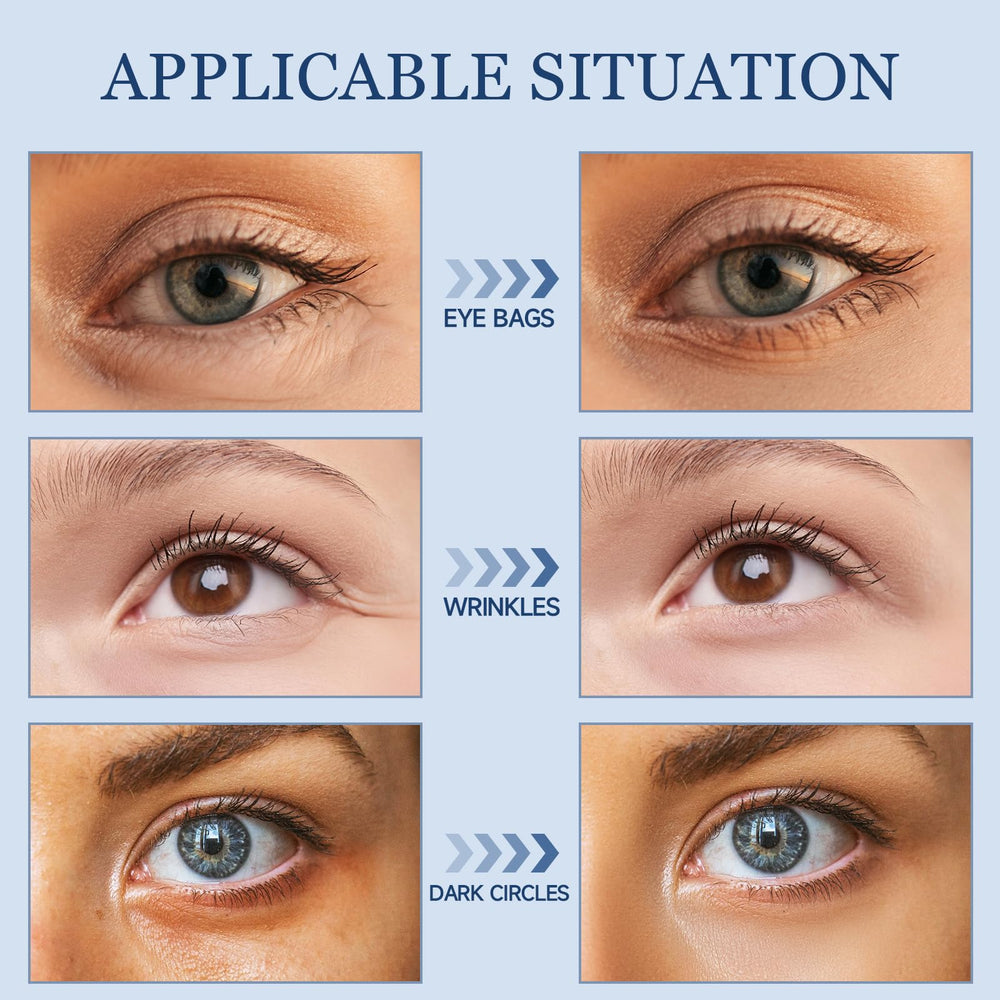 TRIMYFITER eye cream applied around the eyes for refreshed, rested-looking skin.