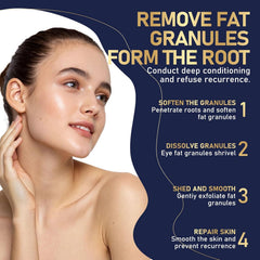 TROMED Milia Remover blemish closeup highlights gentle exfoliation for clearer skin.