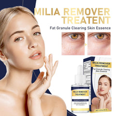 TROMED Milia Remover eye-area application demonstrates safe use on delicate skin.