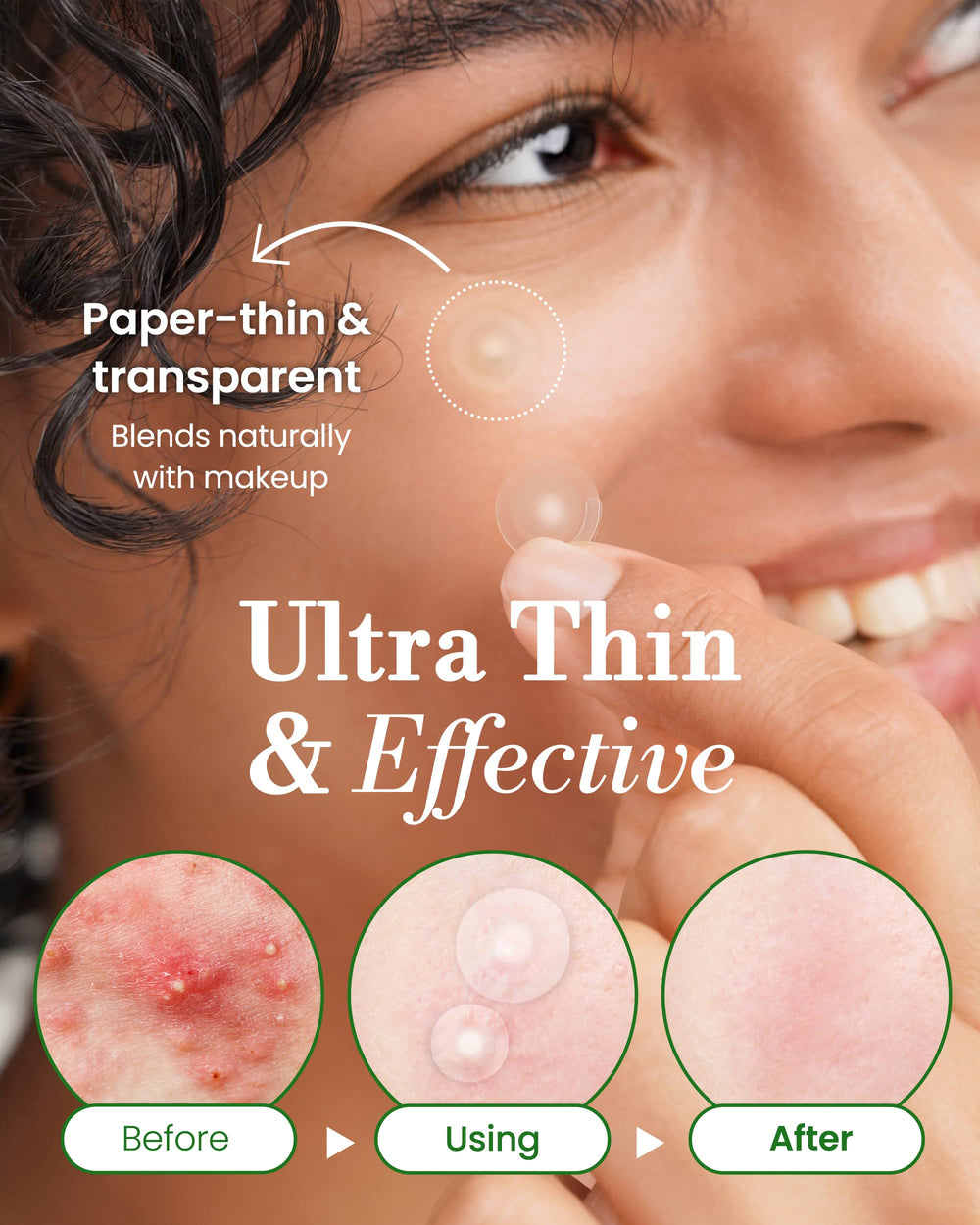 Troubless Two Sizes Patch set covers small to moderate blemishes.