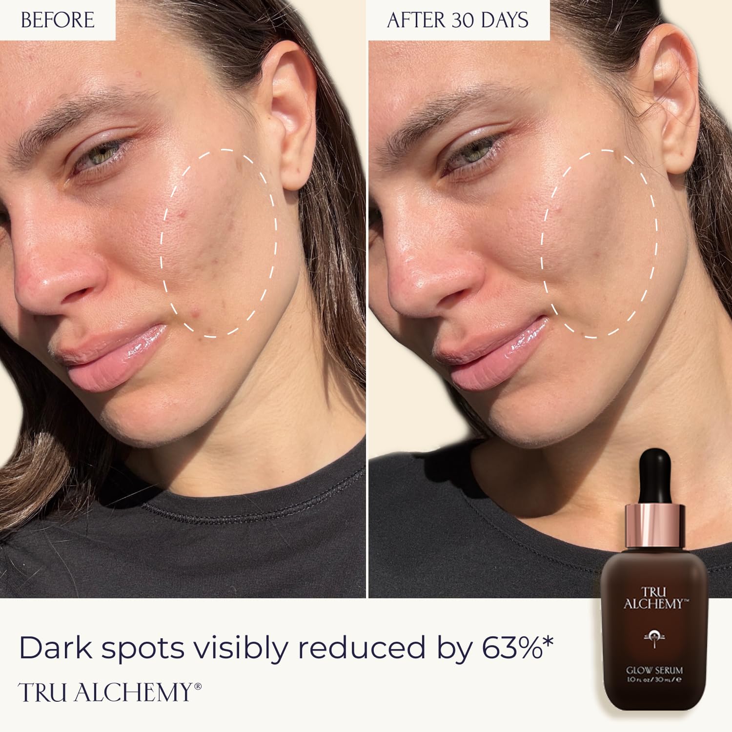 Applying Tru Alchemy Vitamin C Glow Serum to clean skin for quick absorption