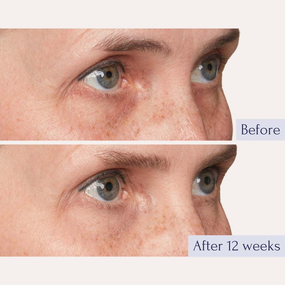 Tru Alchemy Eye Elixir jar cream shows rich texture for hydration.