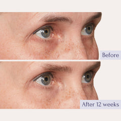 Tru Alchemy Eye Elixir jar cream shows rich texture for hydration.