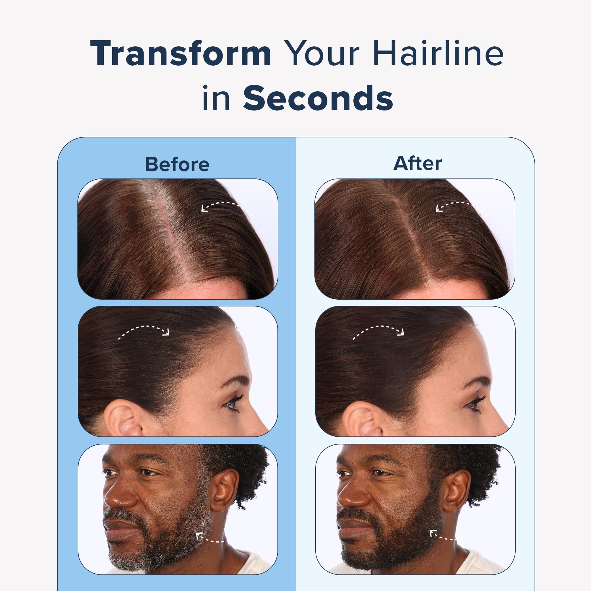 Truhair Jumbo Color & Conceal sponge-application enables precise coverage with minimal mess.
