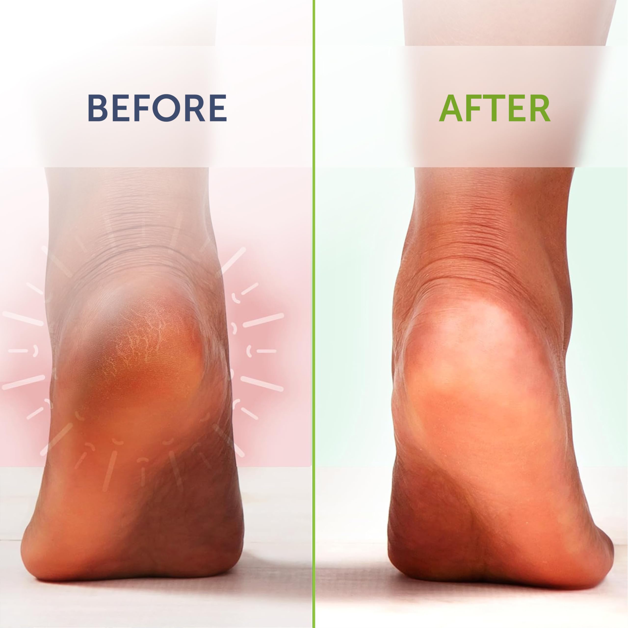 Gift ready packaging of Truremedy Naturals foot soak