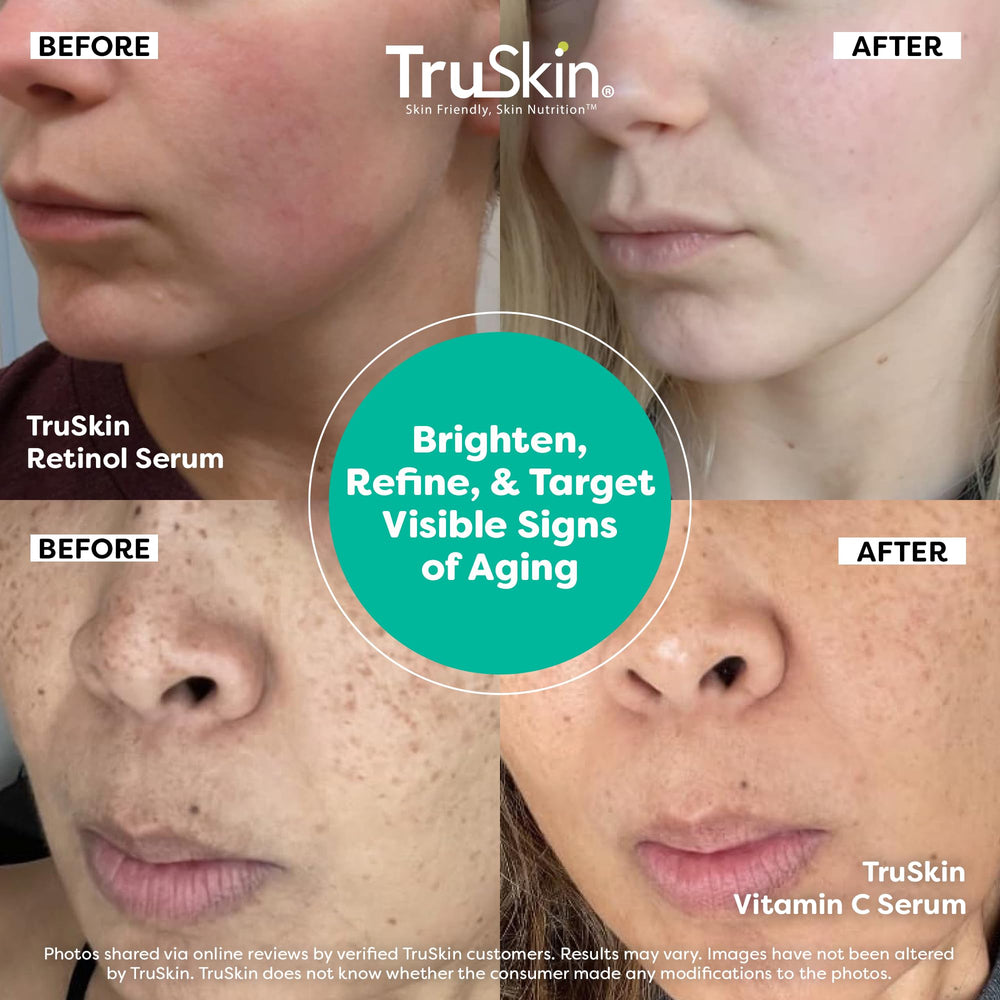 TruSkin serum dropper close-up enabling precise application.