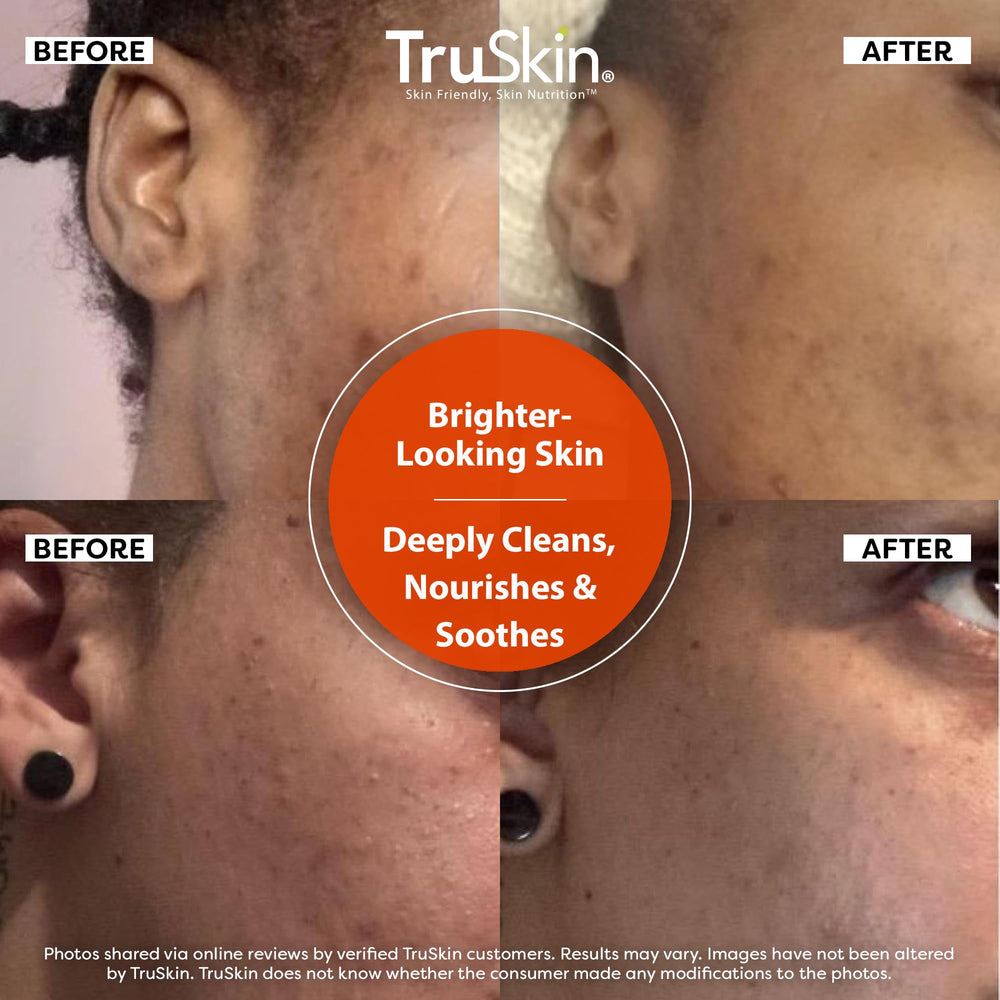 TruSkin Vitamin C Face Wash foamy lather shown during application.
