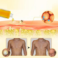 TRWLCFF ThermoFirm Bee Venom Oil close-up on chest application site