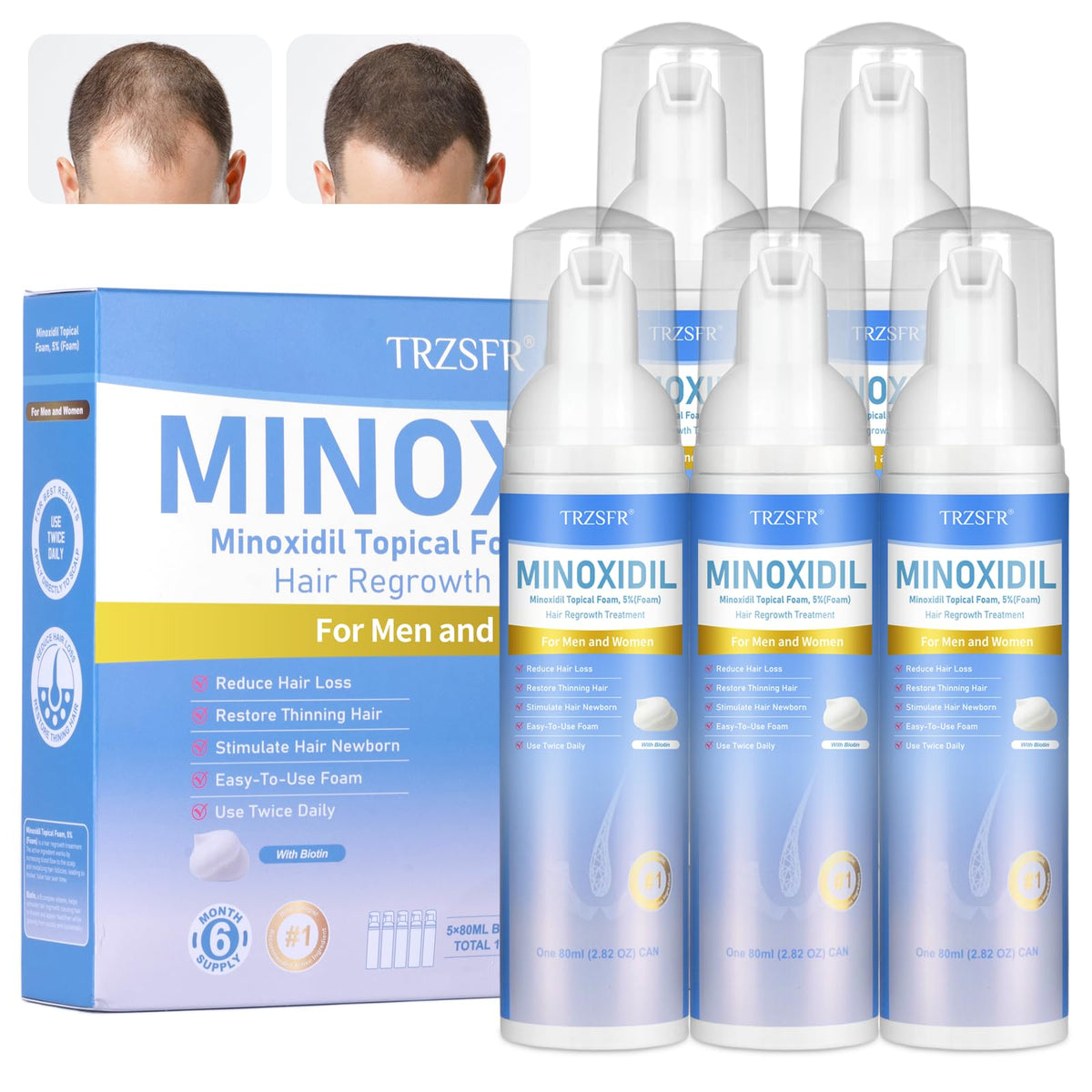 Trzsfr 5% Minoxidil Foam bottle for precise application and potential hair regrowth.
