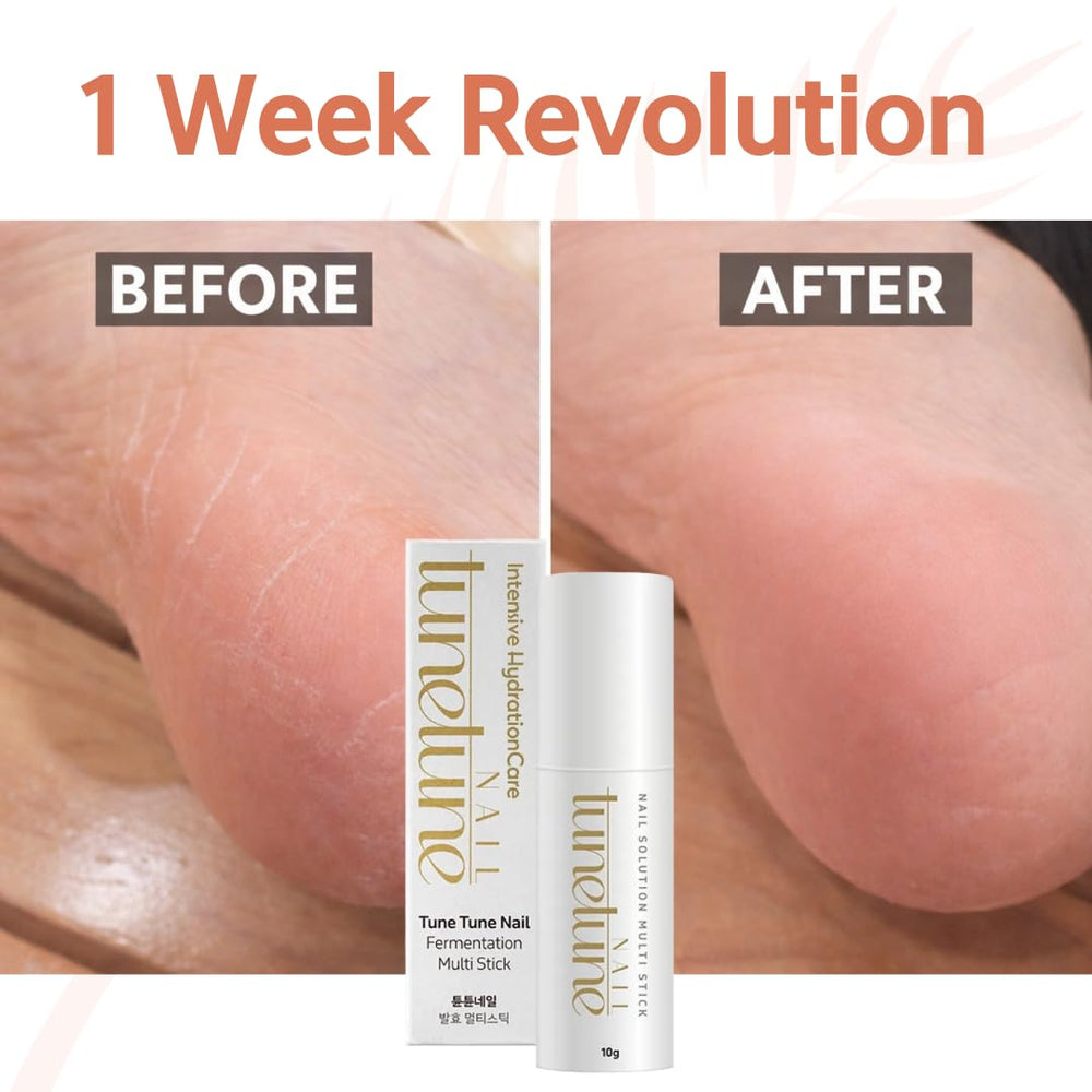 TuneTune Nail Fermentation Multi Stick demonstrates travel-size convenience.
