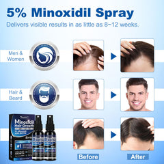 Tuymec beard growth spray applied to facial hair for fuller look