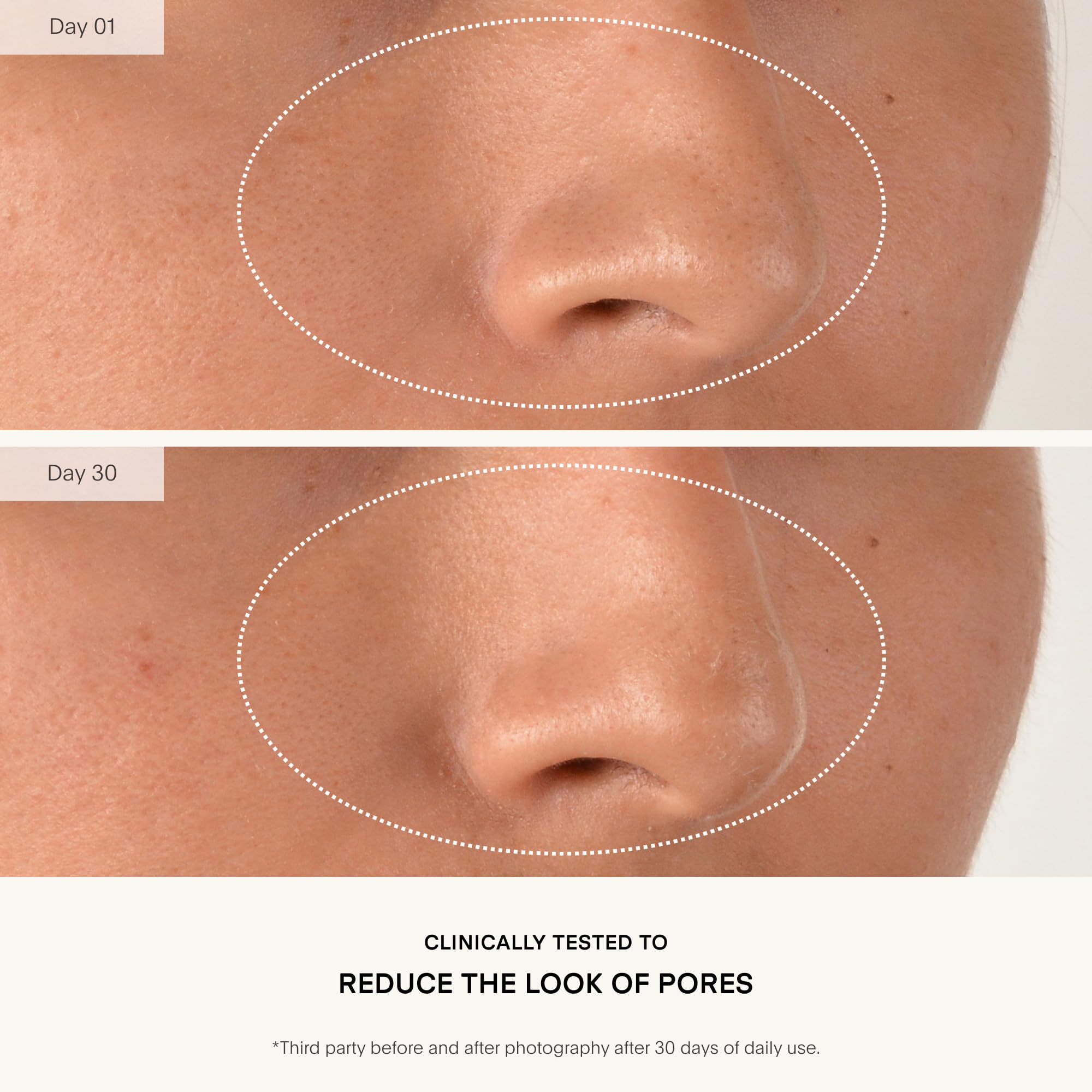 Ingredients list of U Beauty Resurfacing Compound highlighting mandelic acid and vitamin C