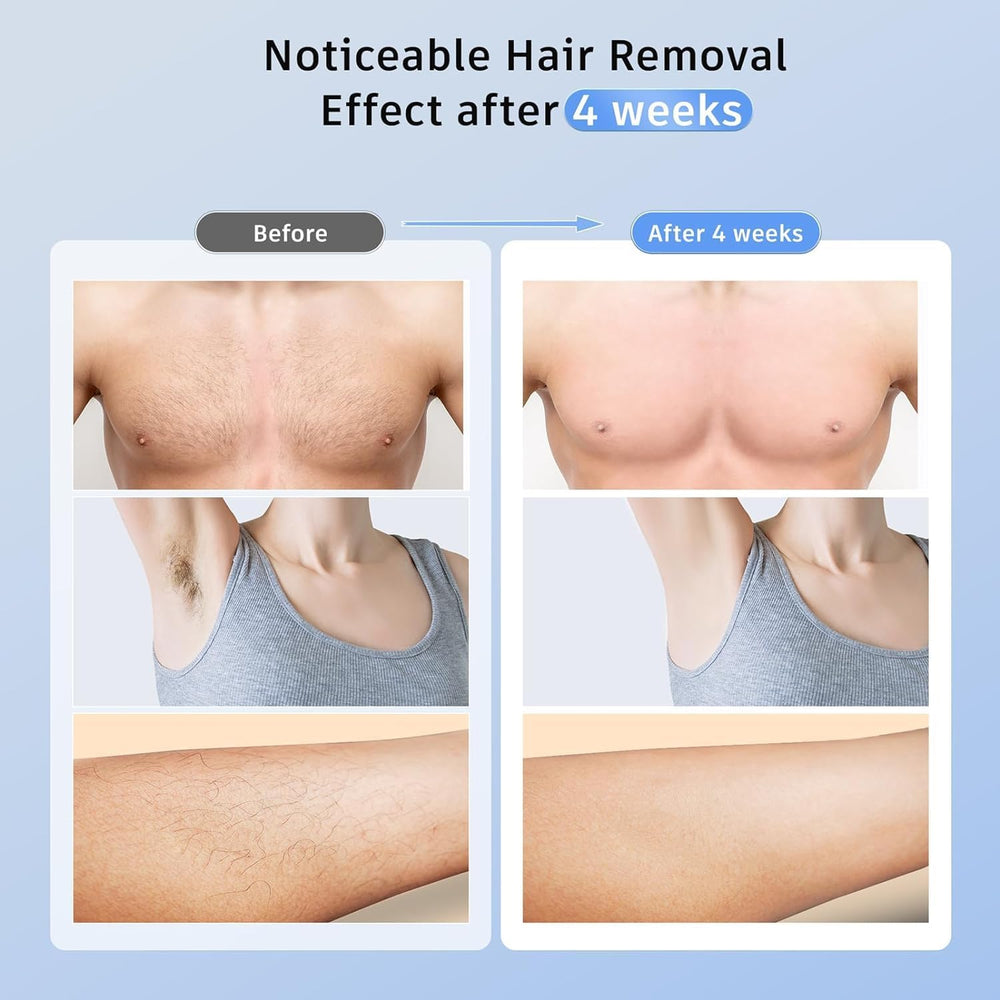 Ubroo IPL device in use on legs for full-body treatment