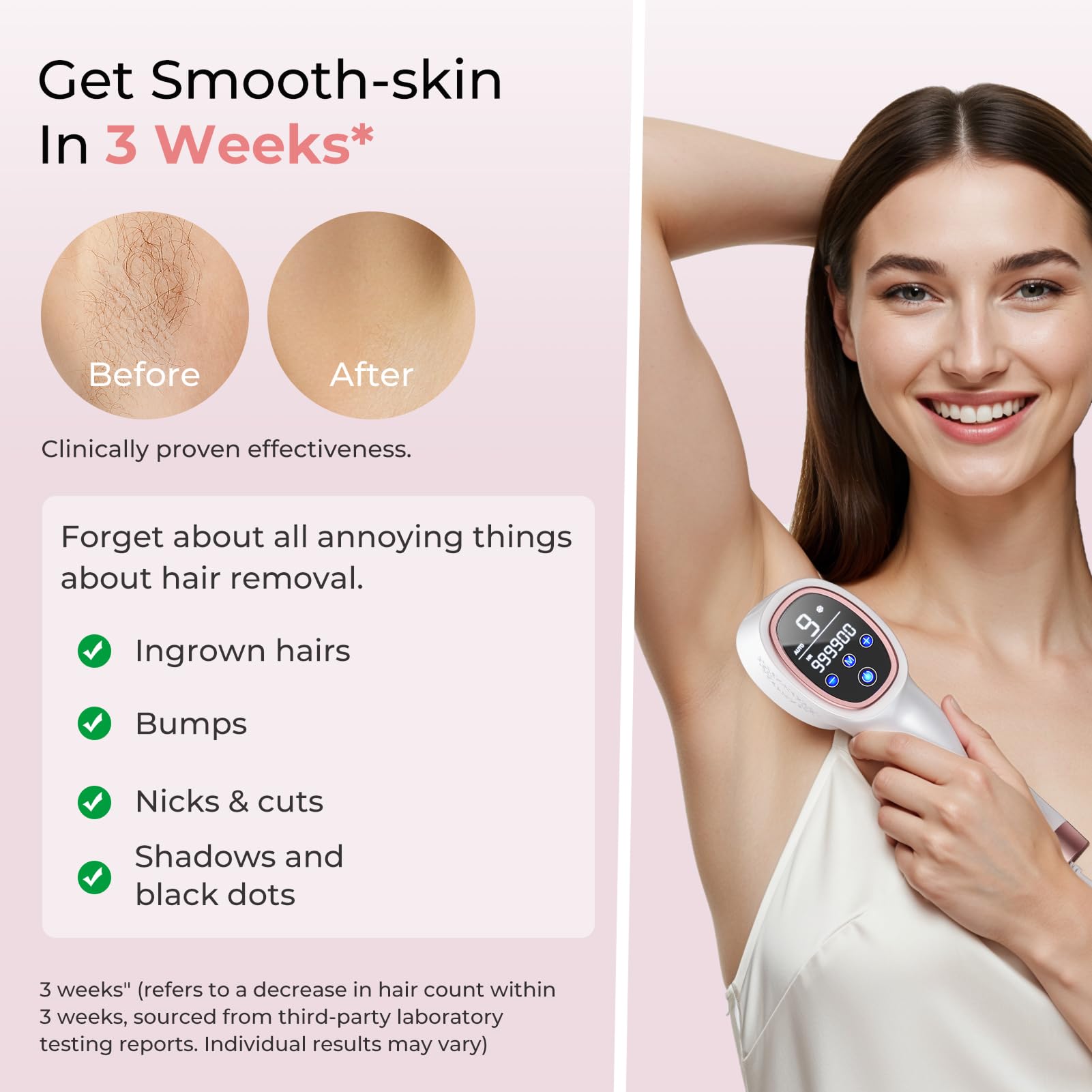 Ubroo IPL energy setting detail for targeting stubborn hair.