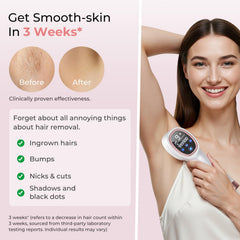 Ubroo IPL energy setting detail for targeting stubborn hair.
