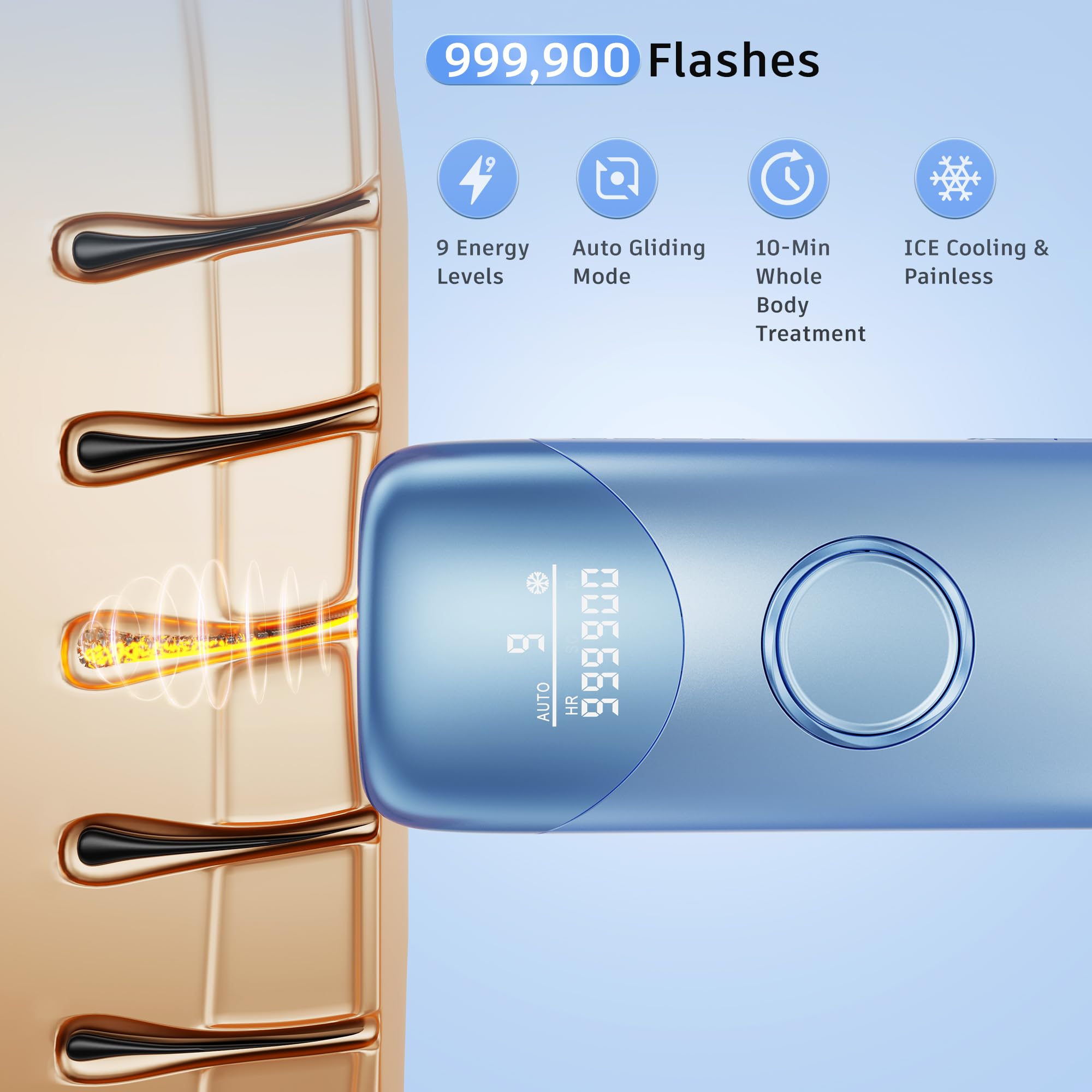 IPL light pulses target hair follicles with potential long-lasting reduction.