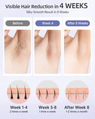 UENMOON IPL device bikini area view for precise targeting.