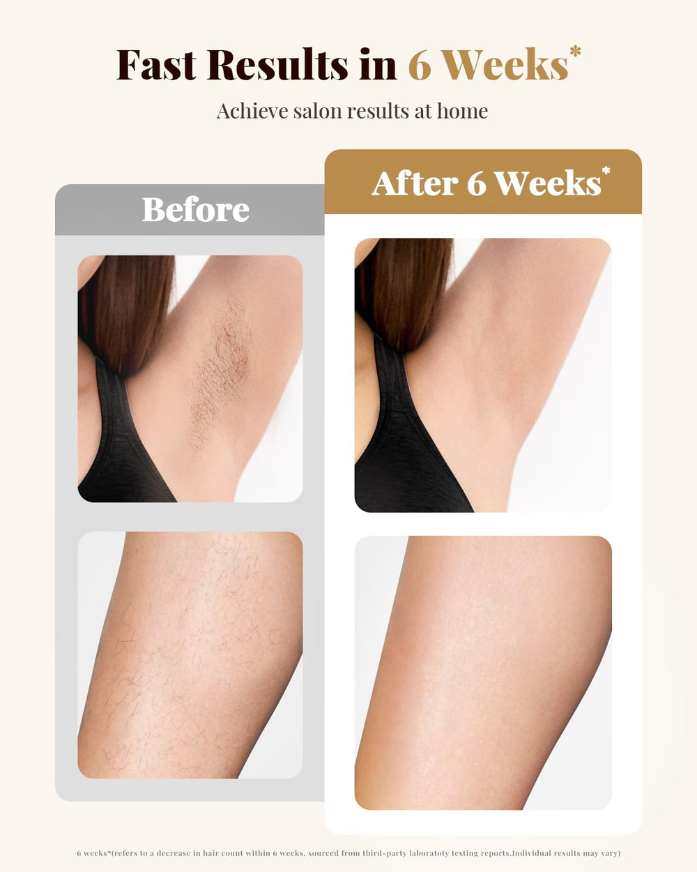 UENMOON IPL Energy Density 13J targets hair roots for effective care.